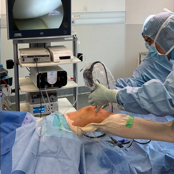 Chirurgie orthop&eacute;dique sous arthroscopie avec contr&ocirc;le vid&eacute;o en salle d&rsquo;op&eacute;ration.